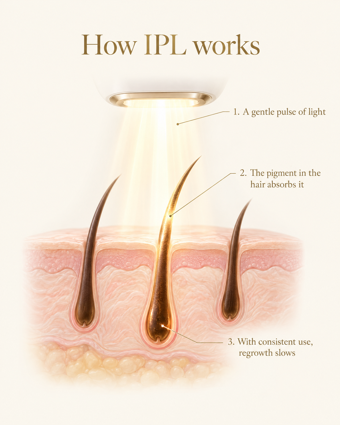 How IPL works: a gentle pulse of light absorbed by the pigment in the hair