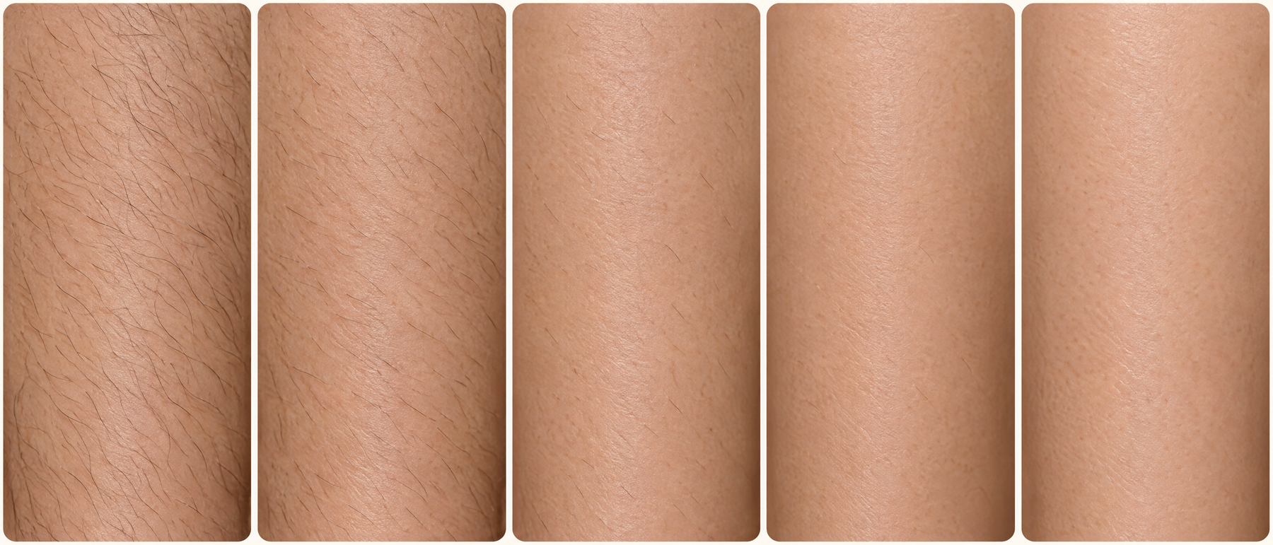 Illustration of gradual hair reduction with consistent use